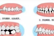 手机拍照时怎样避免脸歪？