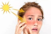 晒黑后如何修复皮肤？有效修复晒伤的步骤和建议是什么？