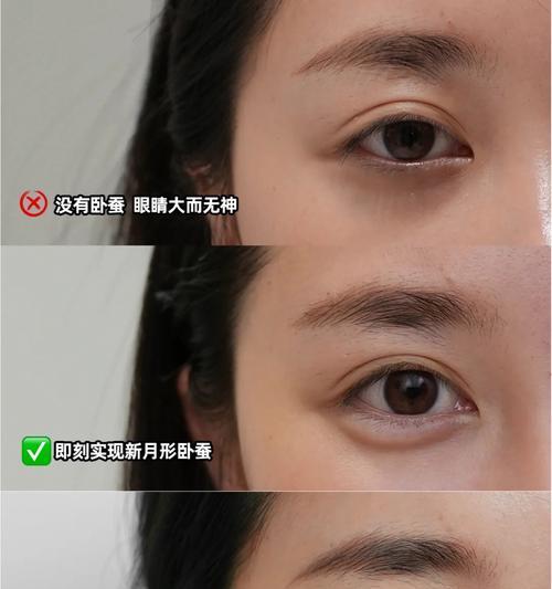 眼袋和卧蚕的区别是什么？如何区分它们？