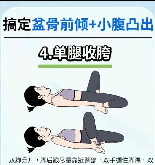 骨盆前倾如何改善？有效方法有哪些？