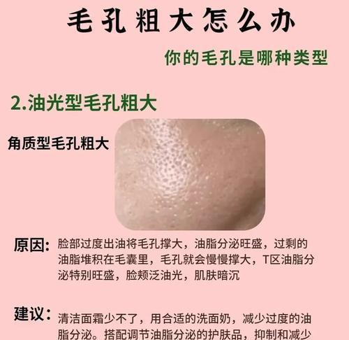 面部毛孔粗大怎么办？收缩毛孔的有效方法有哪些？