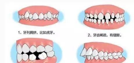 手机拍照时怎样避免脸歪？