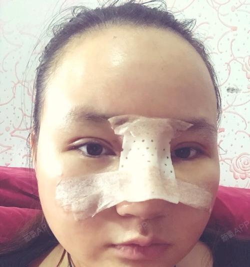 白纱布拍照时手机如何设置？最佳拍摄技巧是什么？