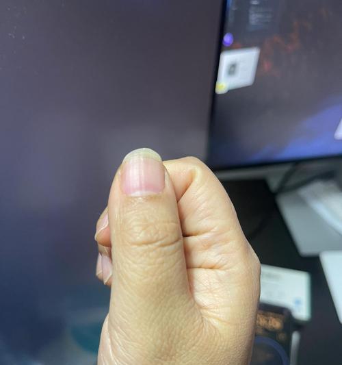 手机拍照出现蓝条纹，是什么原因？