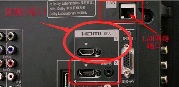 网线连接机顶盒教程视频在哪里找？